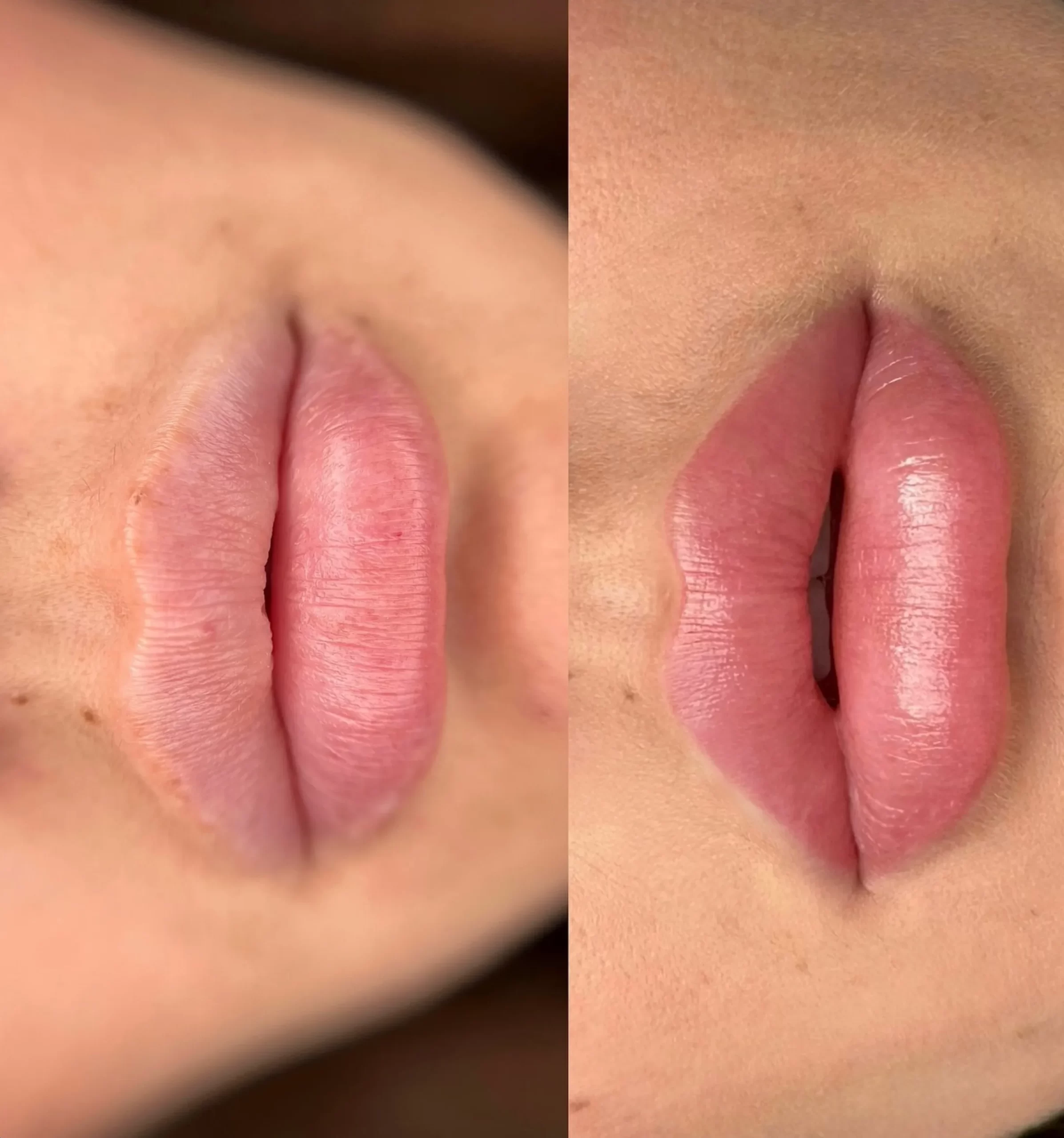 cosmetic lip tattoo before and after