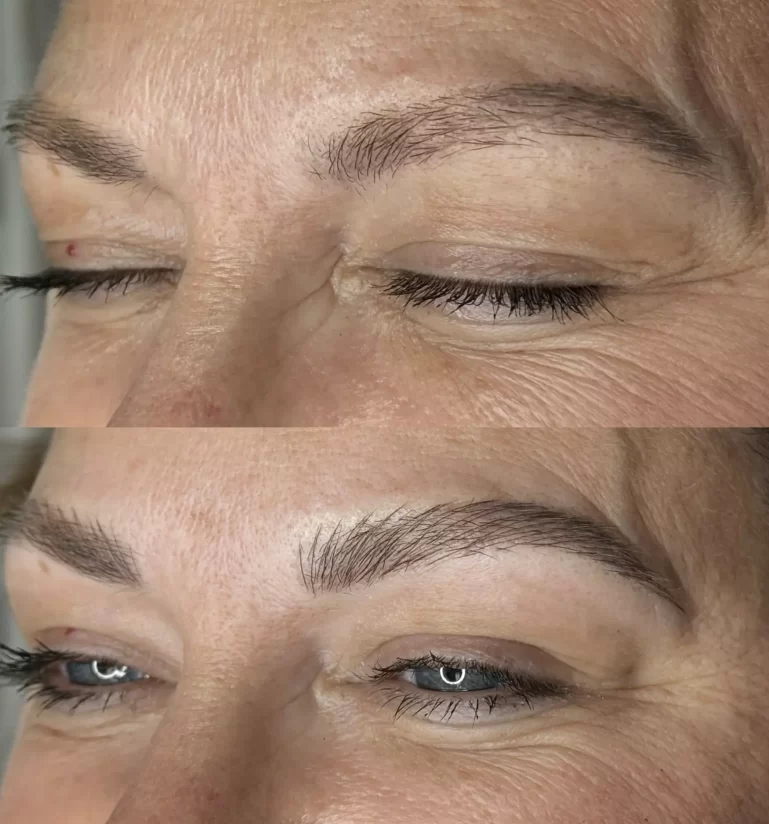 How to fix brows tattoos that are too dark?