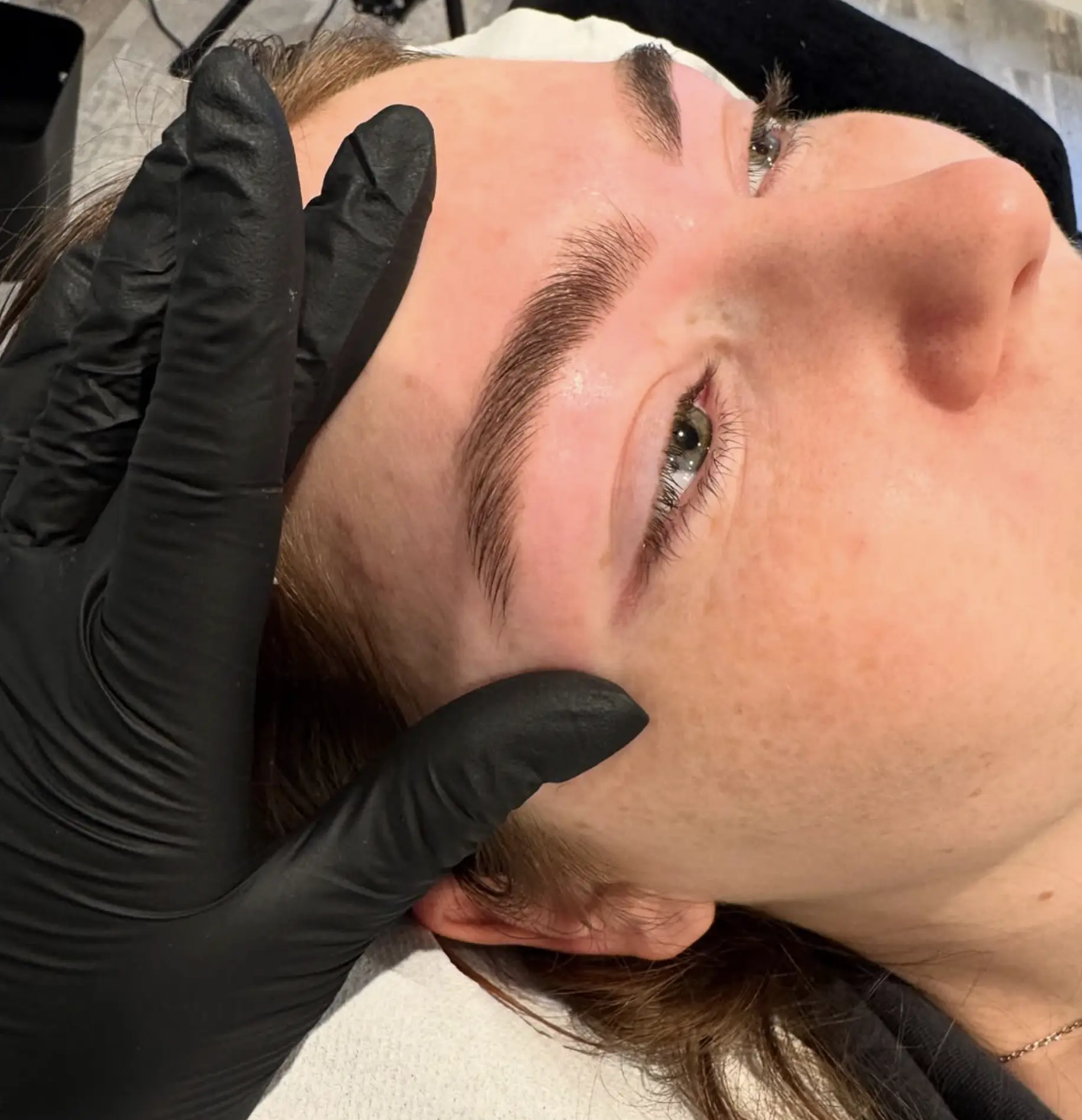Saline tattoo removal service