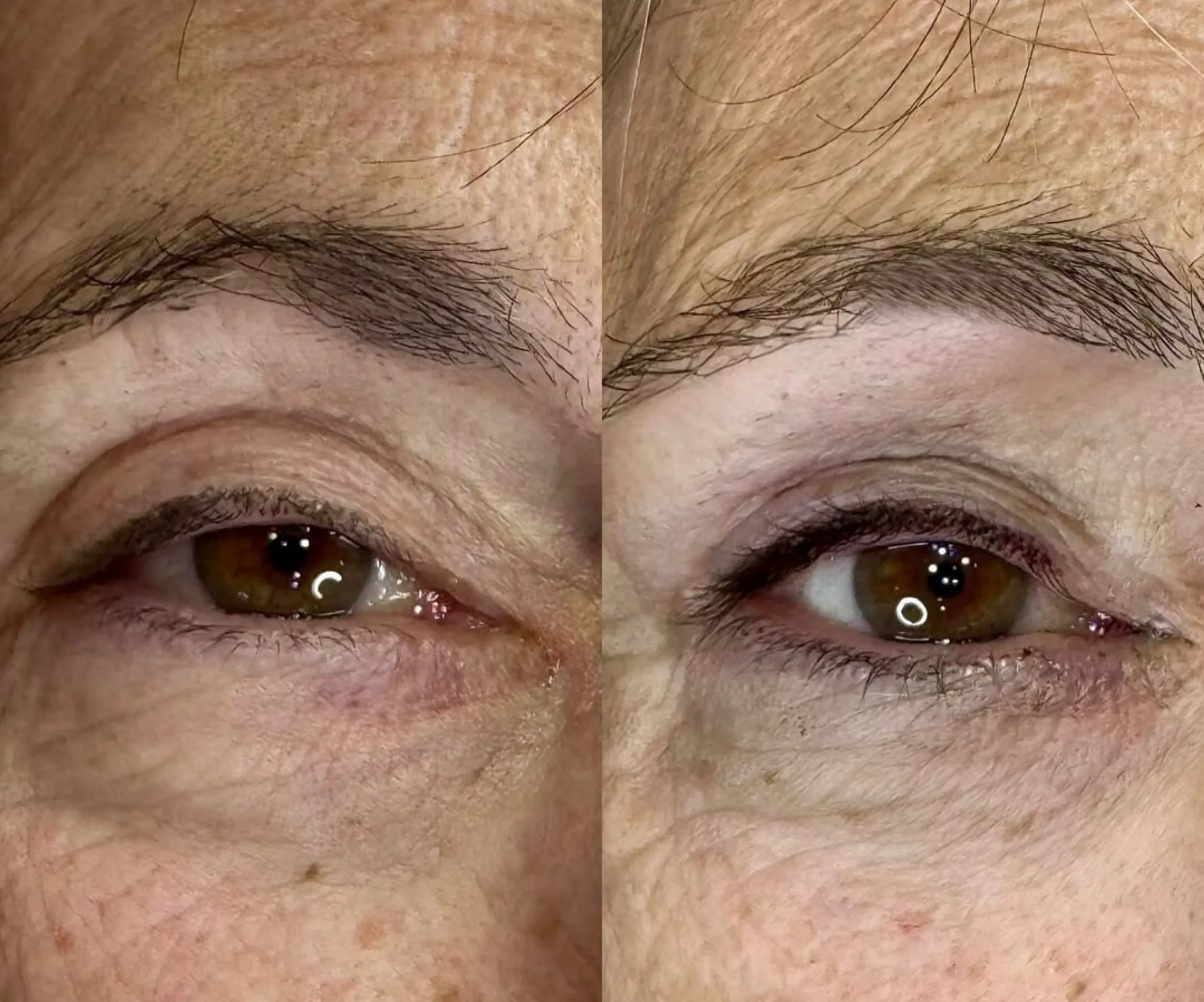pain during lash line tattoo procedure