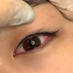 does lash line tattoo hurt