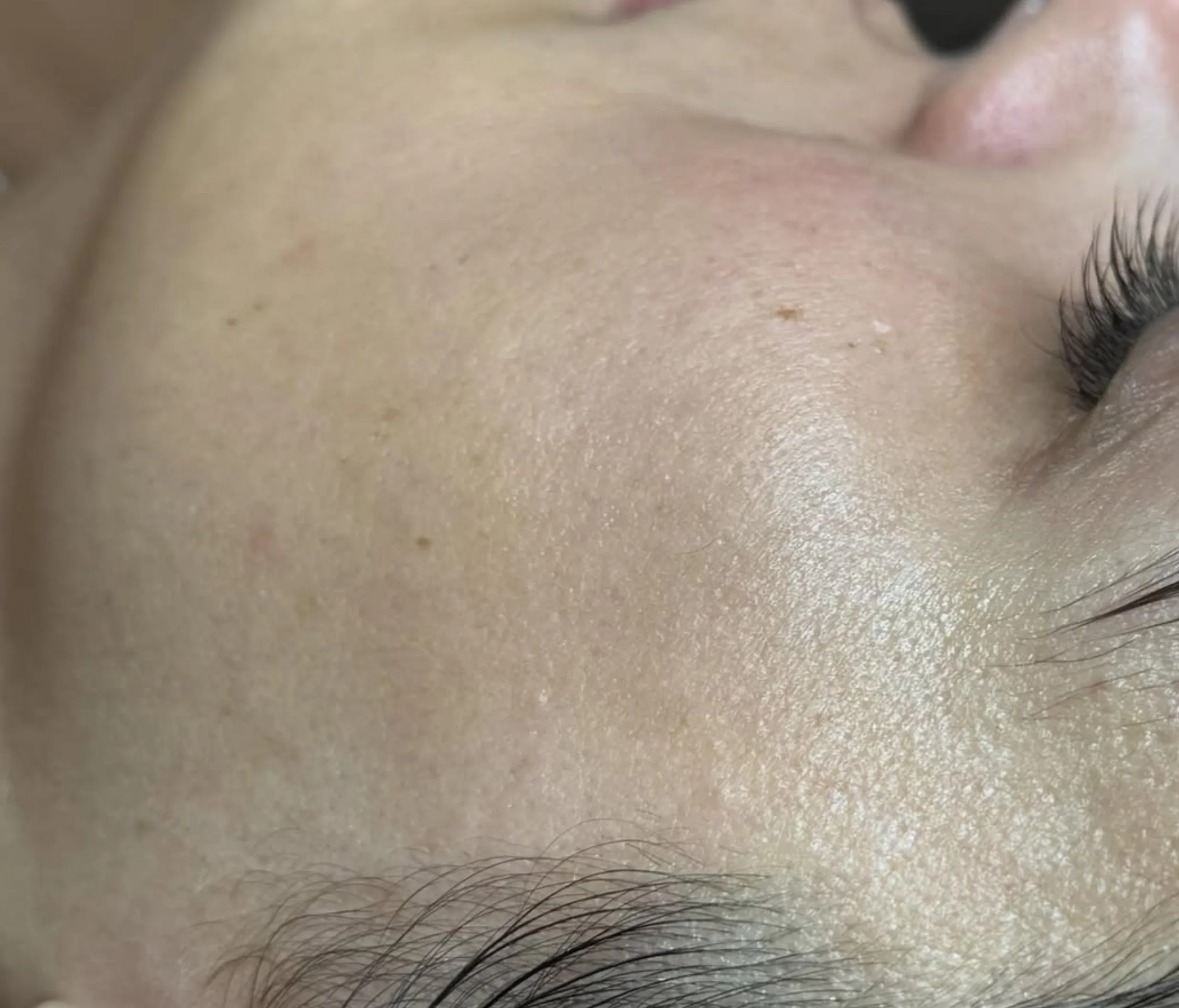 damaged skin barrier signs