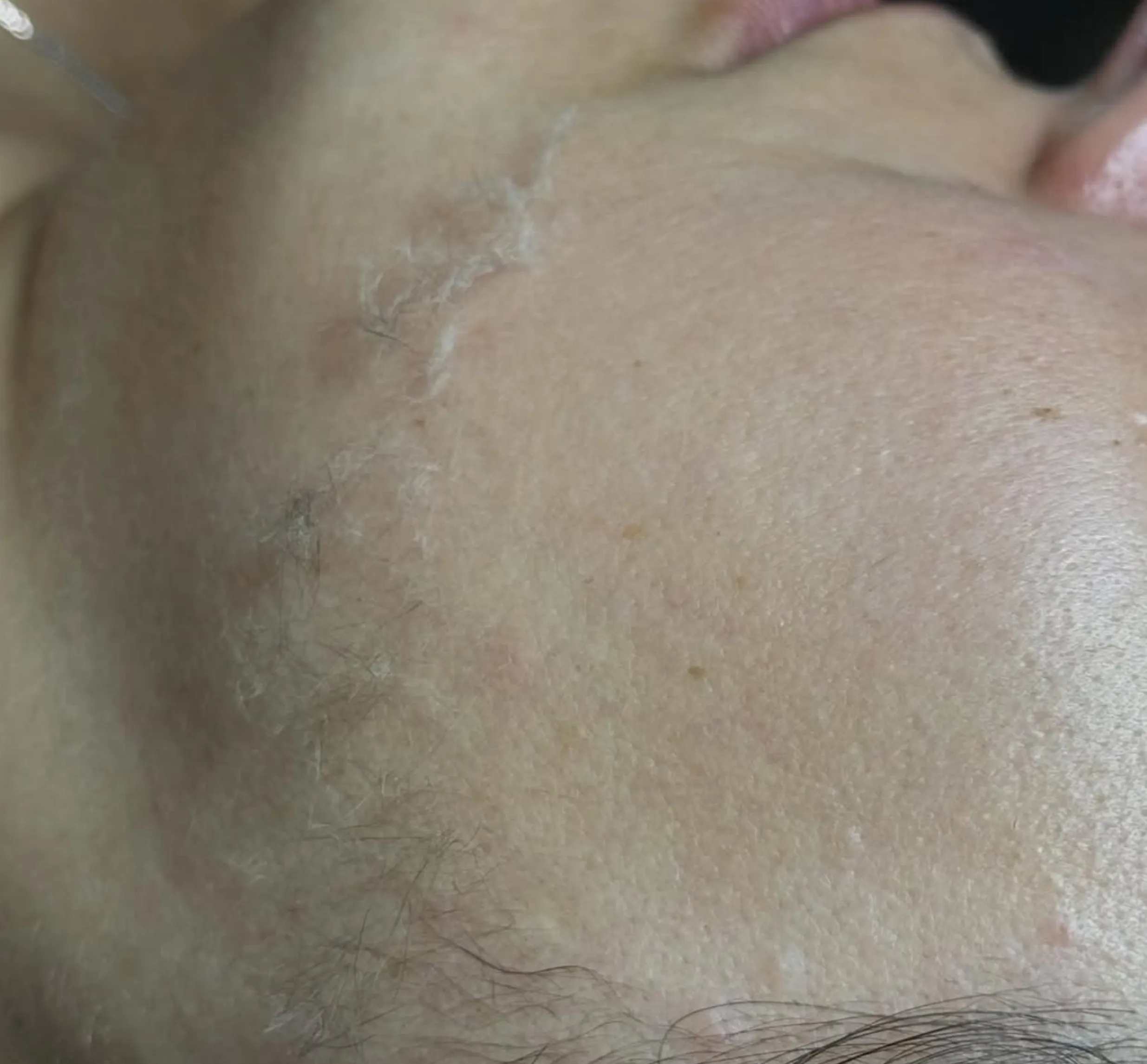 skincare routine mistakes