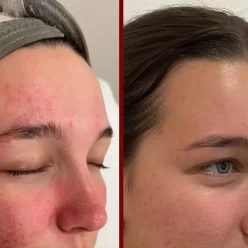 too many active ingredients skincare